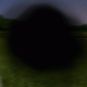 Macular Degeneration Treatment